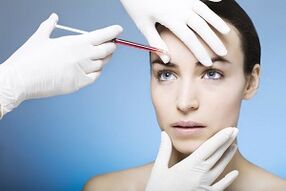 plasmolifting procedures for skin rejuvenation